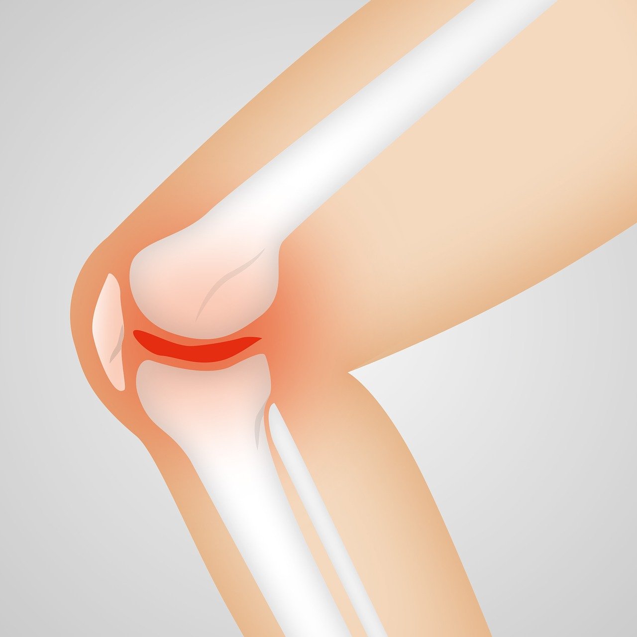 How to lose weight with knee pain